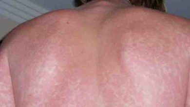 Photo of Symptoms and signs you shouldn’t ignore