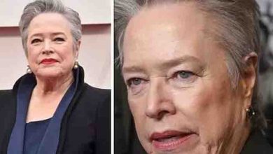 Photo of Veteran actress Kathy Bates diagnosed with serious chronic health condition